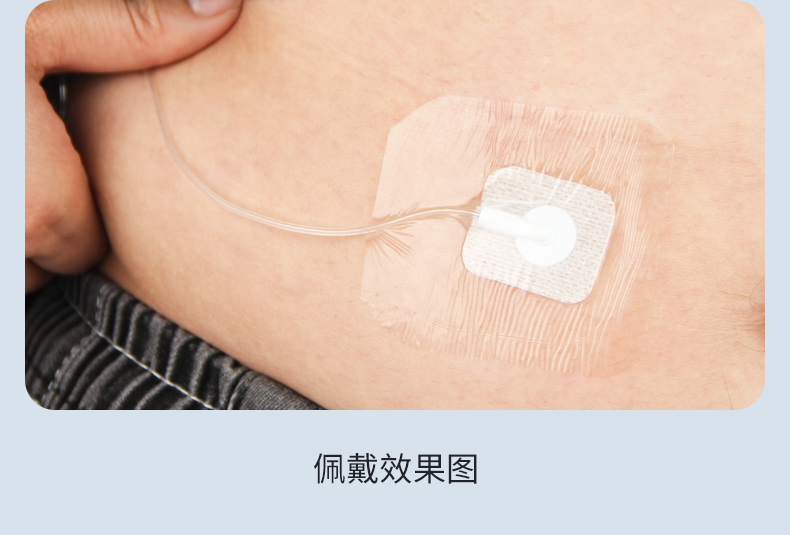 丹纳不分离式输注导管